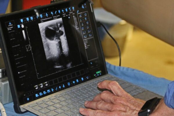 Ultrasound-image-with-hand-